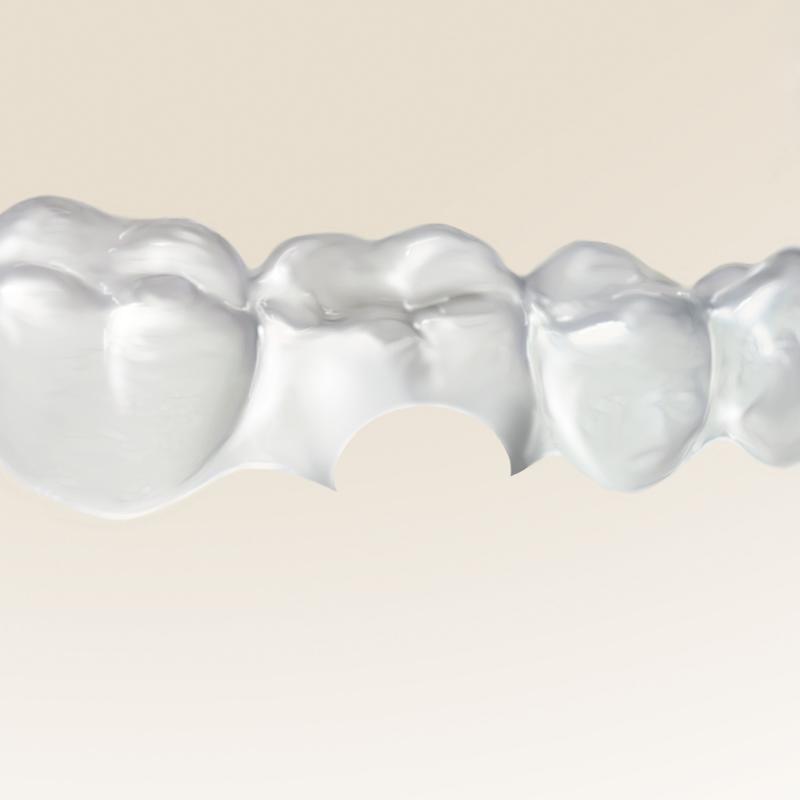 Hu-Friedy® Clear Collection™ The Hole Punch - Image 2